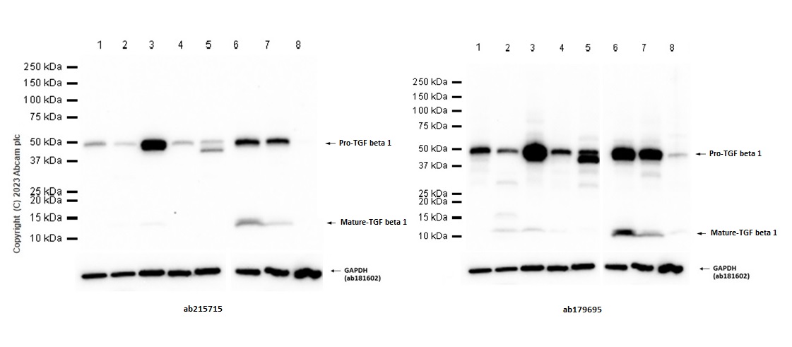 Western blot - Anti-TGF beta 1 antibody [EPR18163] (AB179695)