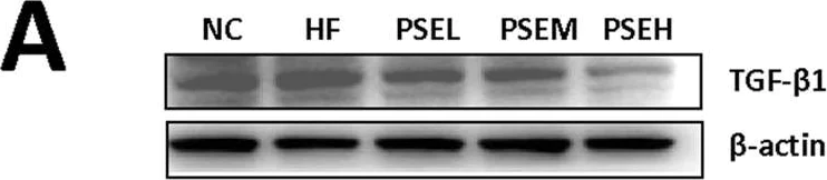 Western blot - Anti-TGF beta 1 antibody [EPR18163] (AB179695)