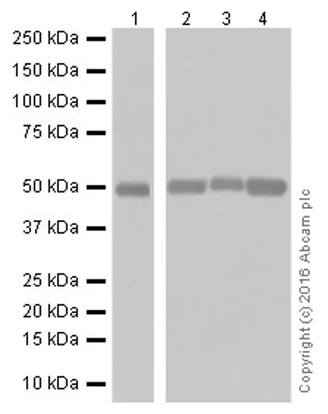 Western blot - Anti-TGF beta 1 antibody [EPR18163] (AB179695)