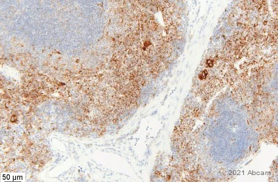 Immunohistochemistry (Formalin/PFA-fixed paraffin-embedded sections) - Anti-TGF beta 1 antibody [EPR21143] (AB215715)