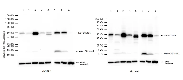 Western blot - Anti-TGF beta 1 antibody [EPR21143] - BSA and Azide free (AB229856)