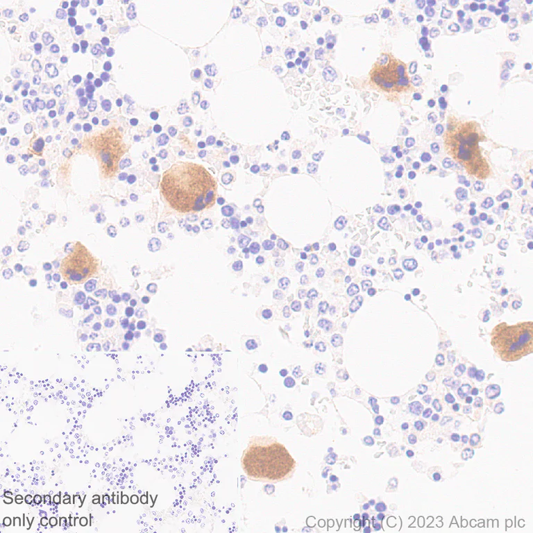 Immunohistochemistry (Formalin/PFA-fixed paraffin-embedded sections) - Anti-TGF beta 1 antibody [RM1088] (AB315254)