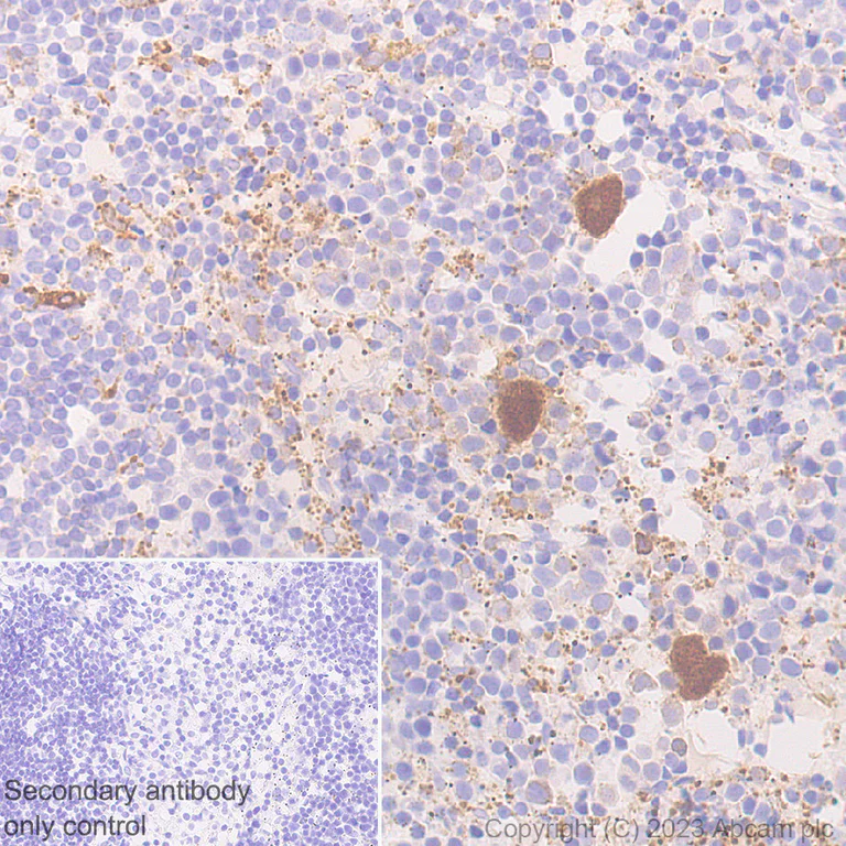 Immunohistochemistry (Formalin/PFA-fixed paraffin-embedded sections) - Anti-TGF beta 1 antibody [RM1088] (AB315254)