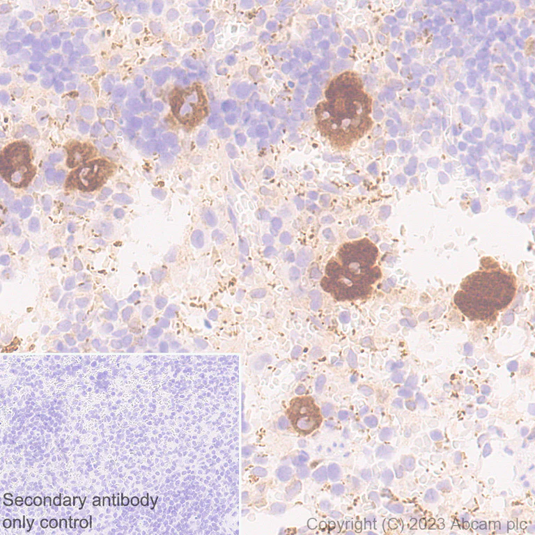 Immunohistochemistry (Formalin/PFA-fixed paraffin-embedded sections) - Anti-TGF beta 1 antibody [RM1088] (AB315254)