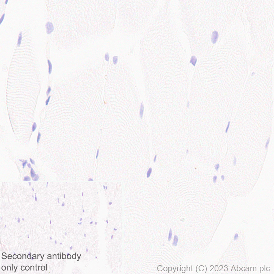 Immunohistochemistry (Formalin/PFA-fixed paraffin-embedded sections) - Anti-TGF beta 1 antibody [RM1088] (AB315254)