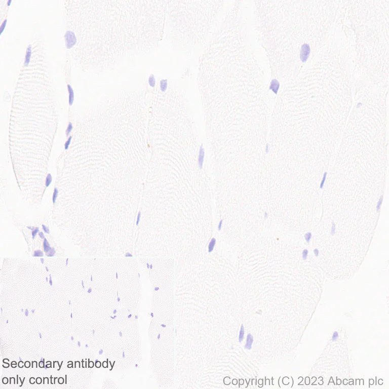 Immunohistochemistry (Formalin/PFA-fixed paraffin-embedded sections) - Anti-TGF beta 1 antibody [RM1088] (AB315254)