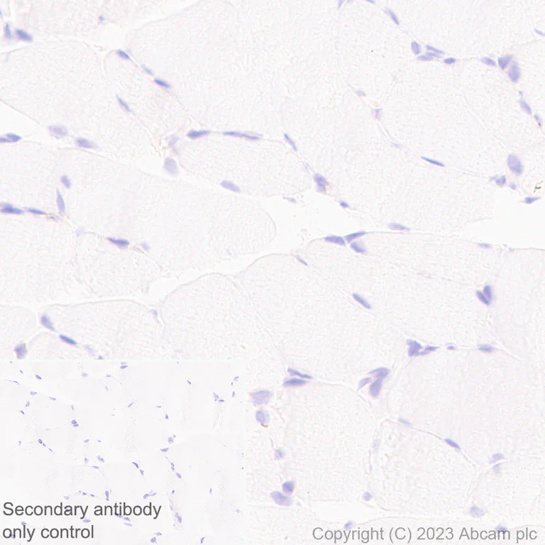 Immunohistochemistry (Formalin/PFA-fixed paraffin-embedded sections) - Anti-TGF beta 1 antibody [RM1088] (AB315254)
