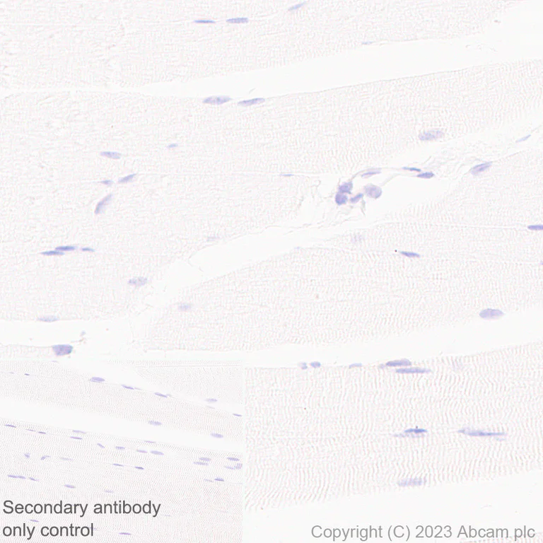 Immunohistochemistry (Formalin/PFA-fixed paraffin-embedded sections) - Anti-TGF beta 1 antibody [RM1088] (AB315254)