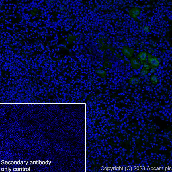 Immunohistochemistry (Frozen sections) - Anti-TGF beta 1 antibody [RM1088] (AB315254)