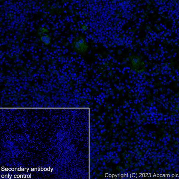 Immunohistochemistry (Frozen sections) - Anti-TGF beta 1 antibody [RM1088] (AB315254)