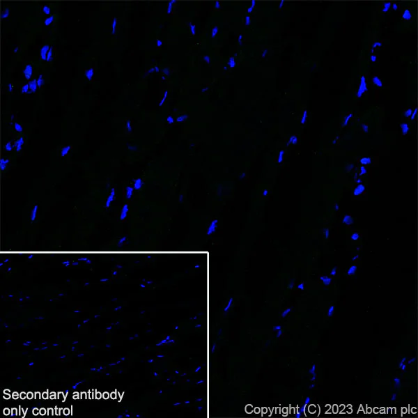 Immunohistochemistry (Frozen sections) - Anti-TGF beta 1 antibody [RM1088] (AB315254)
