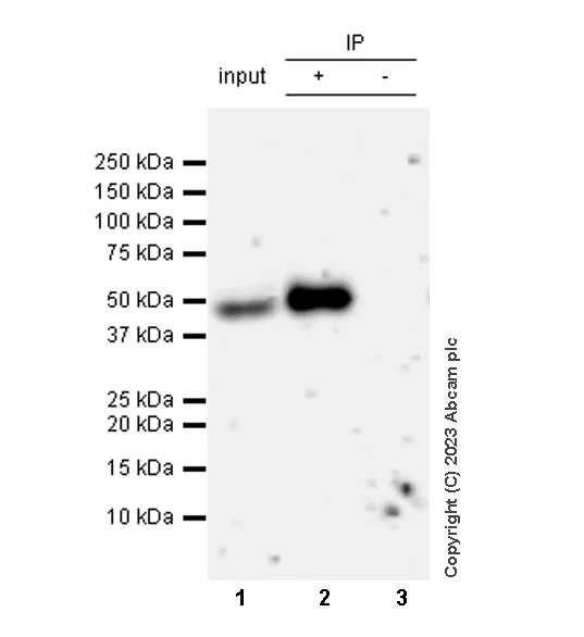 Immunoprecipitation - Anti-TGF beta 1 antibody [RM1088] (AB315254)