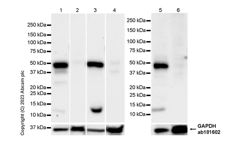 Western blot - Anti-TGF beta 1 antibody [RM1088] (AB315254)