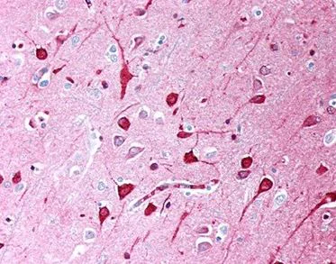 Immunohistochemistry (Formalin/PFA-fixed paraffin-embedded sections) - Anti-TGF beta 1 antibody [TB21] (AB190503)