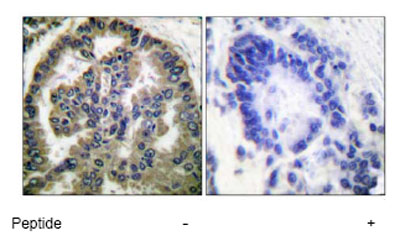 Immunohistochemistry (Formalin/PFA-fixed paraffin-embedded sections) - Anti-TGF beta 2 antibody (AB53778)
