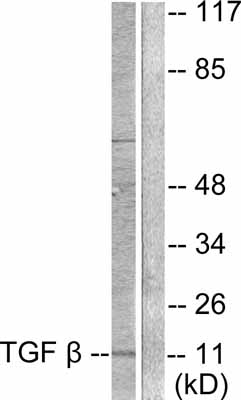 Western blot - Anti-TGF beta 3 antibody (AB53727)