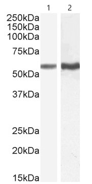 Western blot - Anti-TGF beta Receptor I antibody (AB121024)