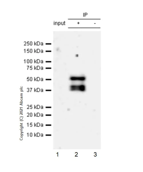 Immunoprecipitation - Anti-TGF beta Receptor I antibody [EPR20923-13] - BSA and Azide free (AB288303)