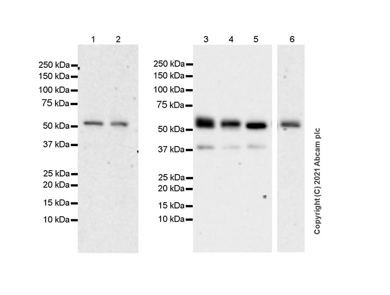 Western blot - Anti-TGF beta Receptor I antibody [EPR20923-13] - BSA and Azide free (AB288303), expandable thumbnail