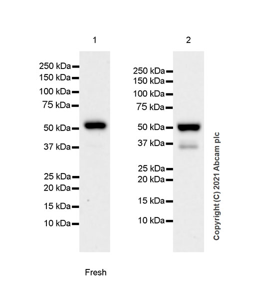 Western blot - Anti-TGF beta Receptor I antibody [EPR20923-13] - BSA and Azide free (AB288303), expandable thumbnail