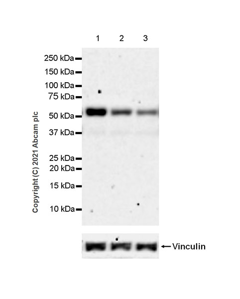 Western blot - Anti-TGF beta Receptor I antibody [EPR20923-13] - BSA and Azide free (AB288303), expandable thumbnail