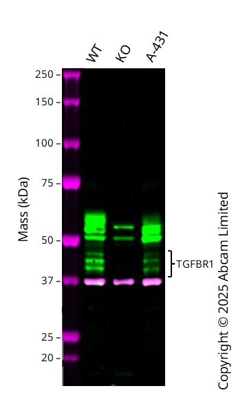 Western blot - Anti-TGF beta Receptor I antibody [EPR20923-13] - BSA and Azide free (AB288303)