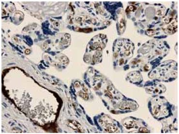 Immunohistochemistry (Formalin/PFA-fixed paraffin-embedded sections) - Anti-TGF beta Receptor I antibody [MM0016-7B09] (AB51871)