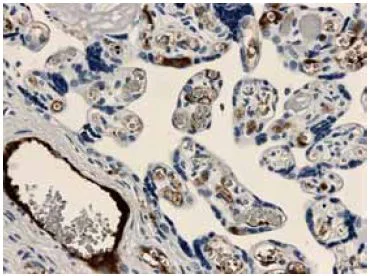 Immunohistochemistry (Formalin/PFA-fixed paraffin-embedded sections) - Anti-TGF beta Receptor I antibody [MM0016-7B09] (AB51871)