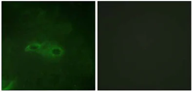 Immunocytochemistry/ Immunofluorescence - Anti-TGF beta Receptor I (phospho S165) antibody (AB112095)