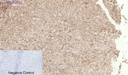 Immunohistochemistry (Formalin/PFA-fixed paraffin-embedded sections) - Anti-TGF beta Receptor I (phospho S165) antibody (AB112095)