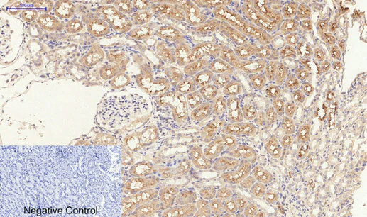 Immunohistochemistry (Formalin/PFA-fixed paraffin-embedded sections) - Anti-TGF beta Receptor I (phospho S165) antibody (AB112095)