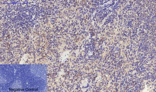 Immunohistochemistry (Formalin/PFA-fixed paraffin-embedded sections) - Anti-TGF beta Receptor I (phospho S165) antibody (AB112095)