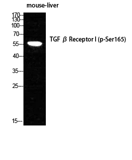 Western blot - Anti-TGF beta Receptor I (phospho S165) antibody (AB112095)