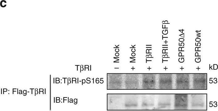 Western blot - Anti-TGF beta Receptor I (phospho S165) antibody (AB112095)