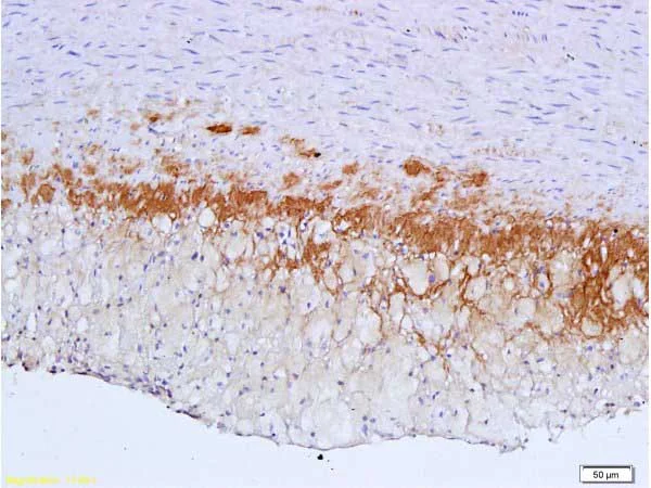 Immunohistochemistry (Formalin/PFA-fixed paraffin-embedded sections) - Anti-TGF beta Receptor II antibody (AB216483)