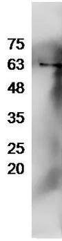 Western blot - Anti-TGF beta Receptor II antibody (AB216483)