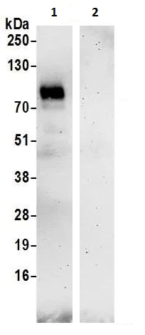 Immunoprecipitation - Anti-TGF beta Receptor II antibody (AB225902)