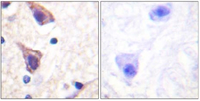 Immunohistochemistry (Formalin/PFA-fixed paraffin-embedded sections) - Anti-TGF beta Receptor II antibody (AB61213)