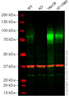 Western blot - Anti-TGF beta Receptor II antibody [EPR14673] (AB184948), expandable thumbnail