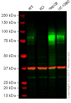 Western blot - Anti-TGF beta Receptor II antibody [EPR14673] (AB184948)