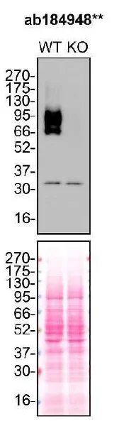 Western blot - Anti-TGF beta Receptor II antibody [EPR14673] (AB184948)