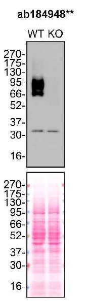 Western blot - Anti-TGF beta Receptor II antibody [EPR14673] - BSA and Azide free (AB236136)