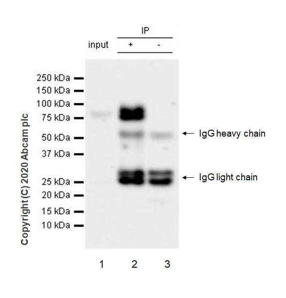 Immunoprecipitation - Anti-TGF beta Receptor II antibody [EPR23148-21] - BSA and Azide free (AB272323)