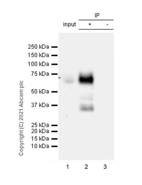 Immunoprecipitation - Anti-TGF beta Receptor II antibody [EPR24349-124] (AB259360), expandable thumbnail