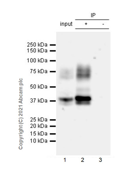 Immunoprecipitation - Anti-TGF beta Receptor II antibody [EPR24349-124] (AB259360), expandable thumbnail