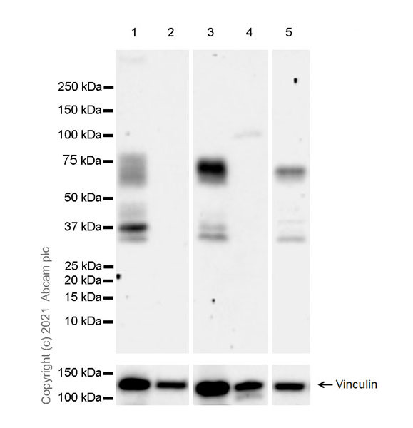 Western blot - Anti-TGF beta Receptor II antibody [EPR24349-124] (AB259360), expandable thumbnail