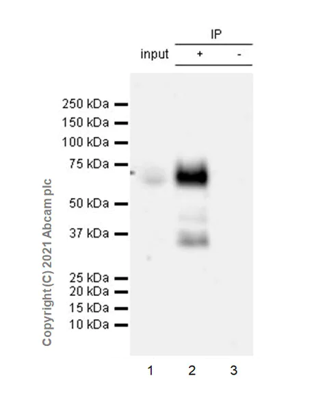 Immunoprecipitation - Anti-TGF beta Receptor II antibody [EPR24349-124] - BSA and Azide free (AB283230)