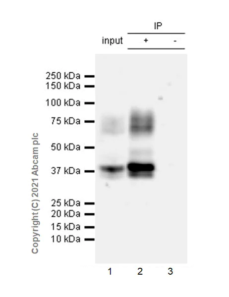 Immunoprecipitation - Anti-TGF beta Receptor II antibody [EPR24349-124] - BSA and Azide free (AB283230)