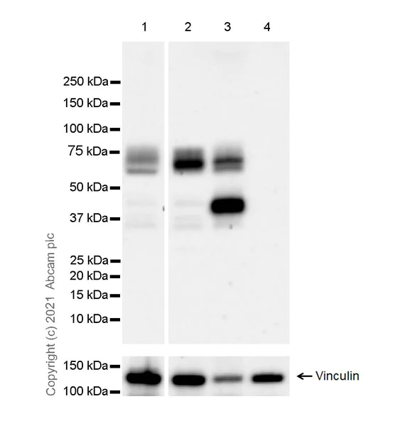 Western blot - Anti-TGF beta Receptor II antibody [EPR24349-124] - BSA and Azide free (AB283230)