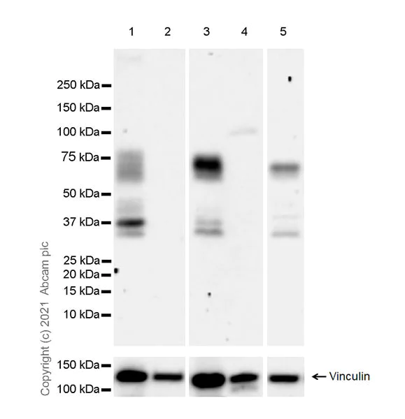 Western blot - Anti-TGF beta Receptor II antibody [EPR24349-124] - BSA and Azide free (AB283230)